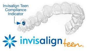 invisalign teeth