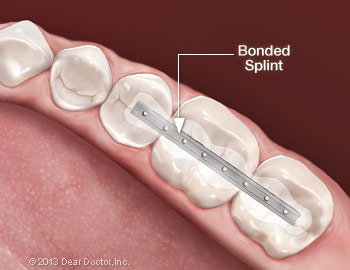 dental equipment