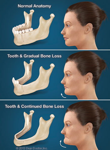 dental treatment