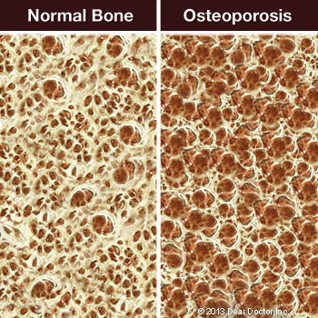 bacteria comparison