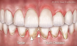 teeth