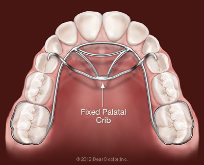 Inside of mouth