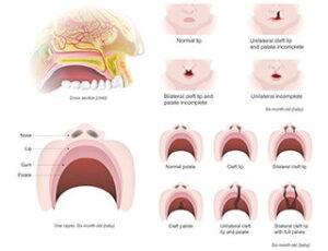 teeth graph