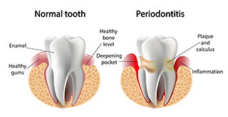 tooth comparison