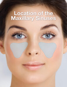 Location of the sinuses.